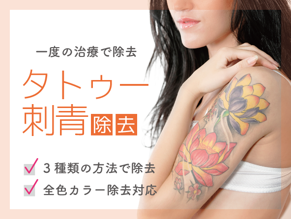タトゥー除去