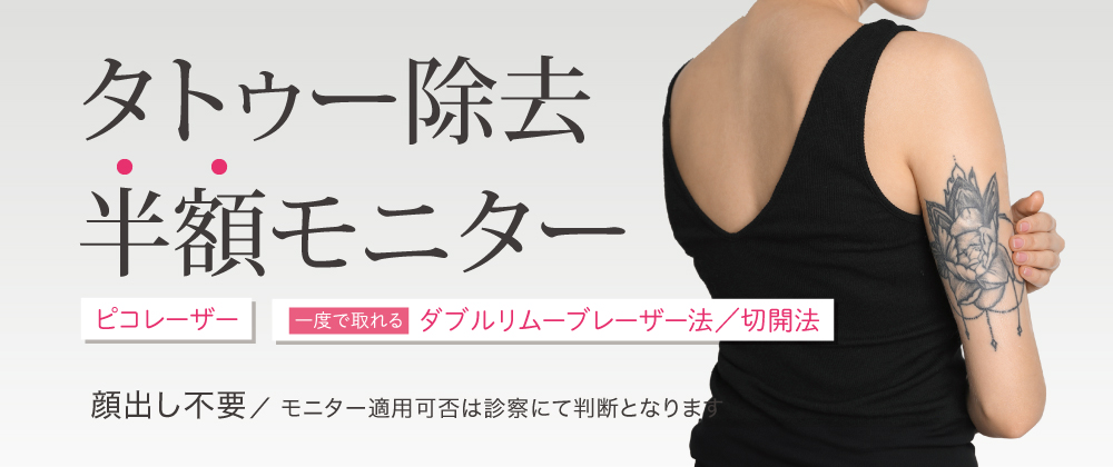 タトゥー除去半額モニター